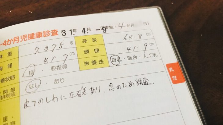 赤ちゃんの太ももの左右シワの違いから乳児股関節脱臼の疑いありと健診で診断され東大病院で精密検査…レントゲン診察の結果はいかに。