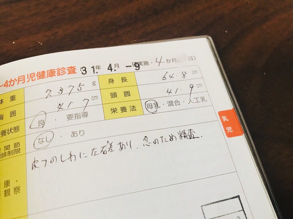 赤ちゃんの太ももの左右シワの違いから乳児股関節脱臼の疑いありと健診で診断され東大病院で精密検査 レントゲン診察の結果はいかに えどりずむ